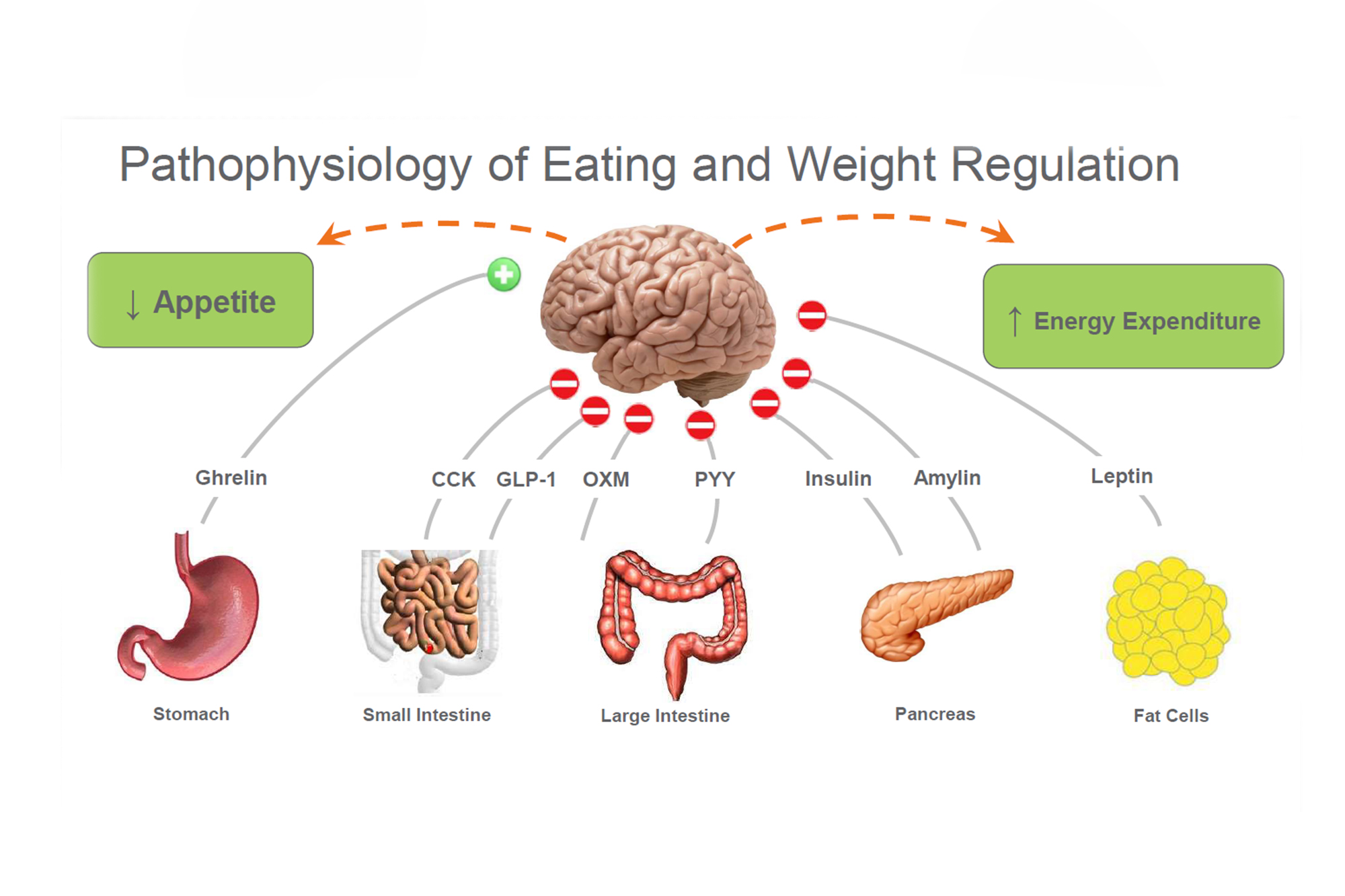 Explaining the pathophysiology of Obesity Onestop