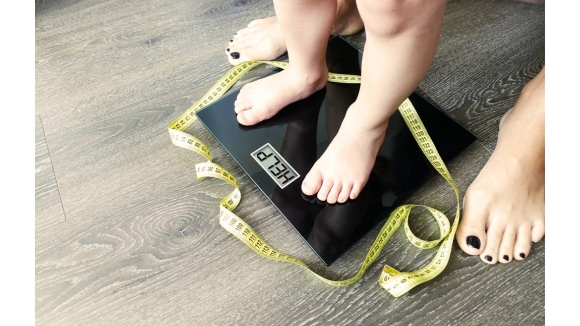 Obesity focused history exam and  Assessment