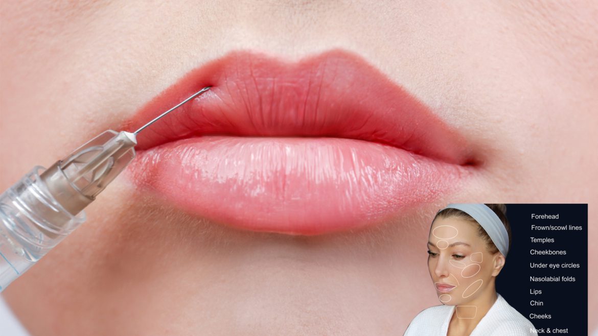 Everything You Need to Know About Botox and Dermal Fillers in Pleasanton!