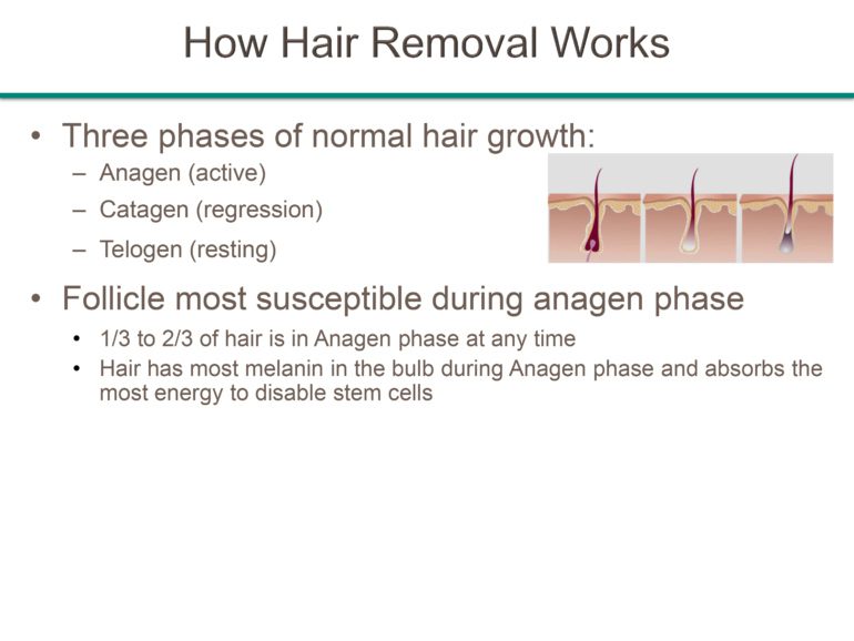 Best Laser Hair Removal Diode hair Removal