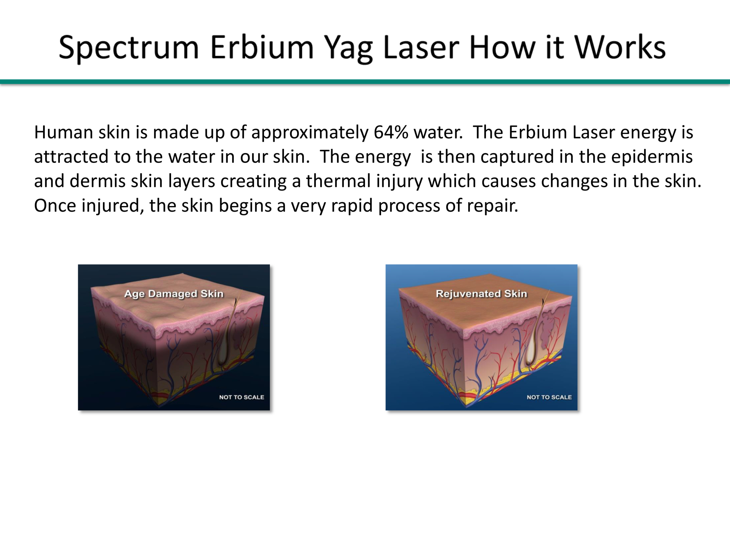Erbium Yar Laser Resurfacing