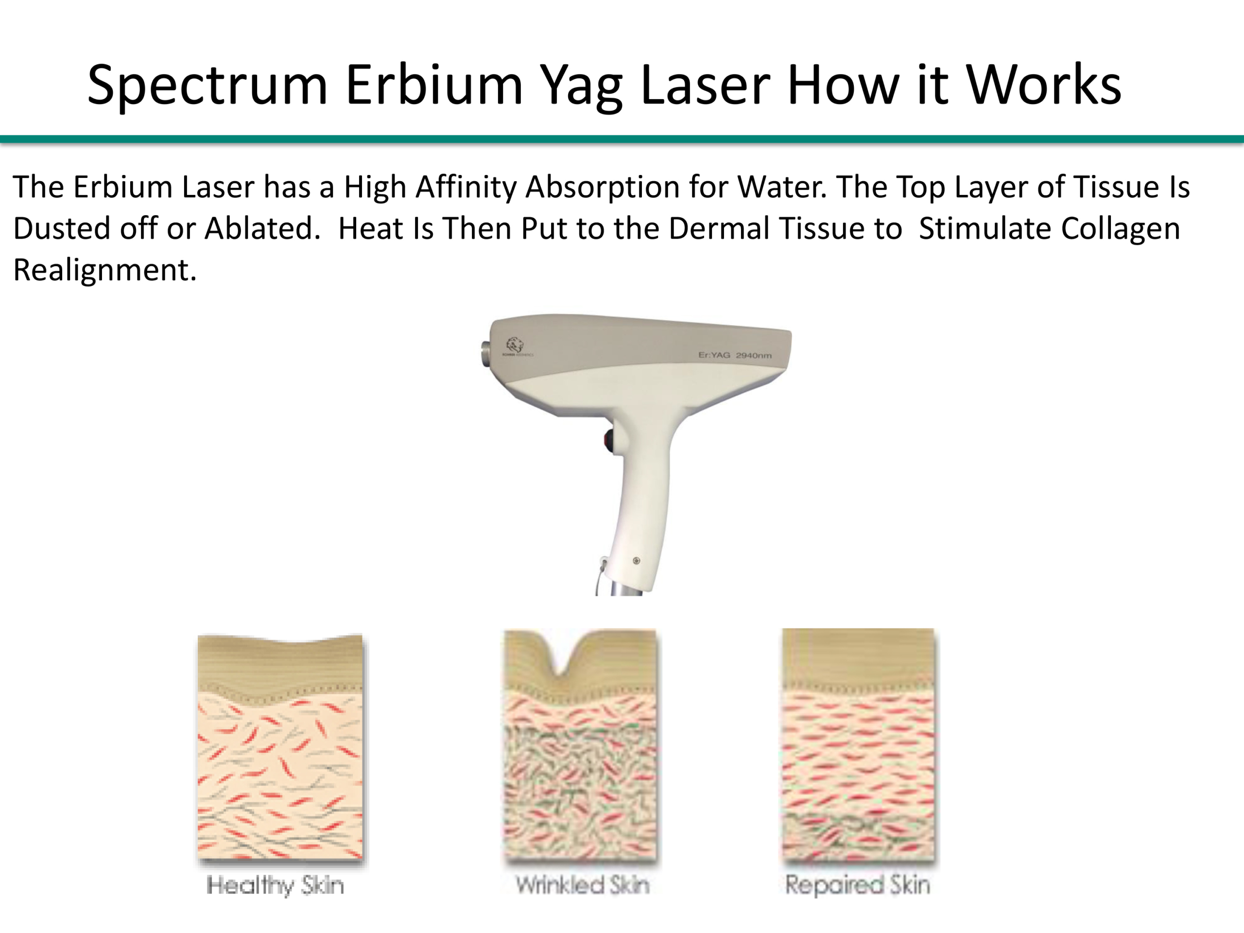spectrum erbium yag laser