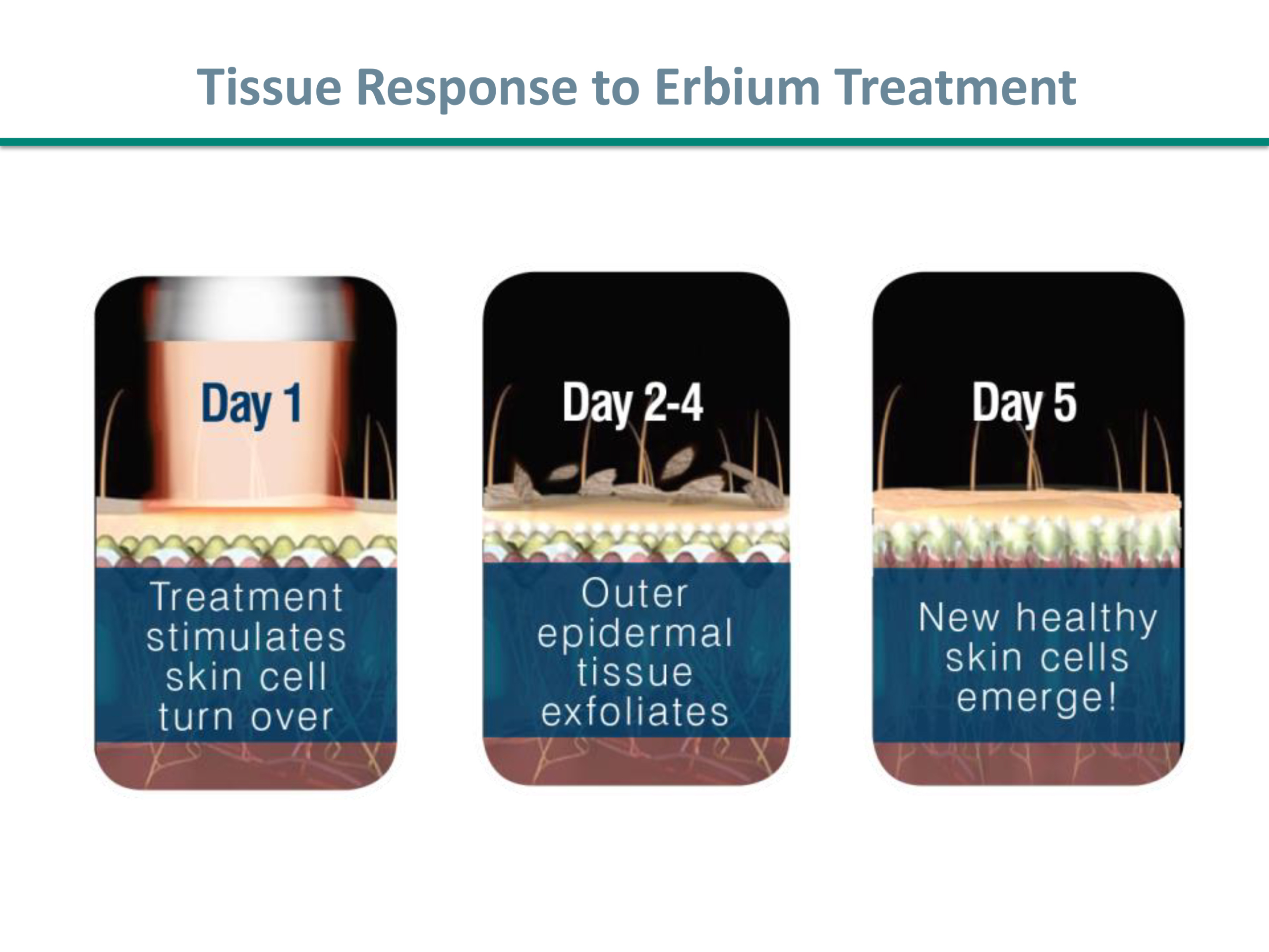 Tissue response to Erbium YAG treatment