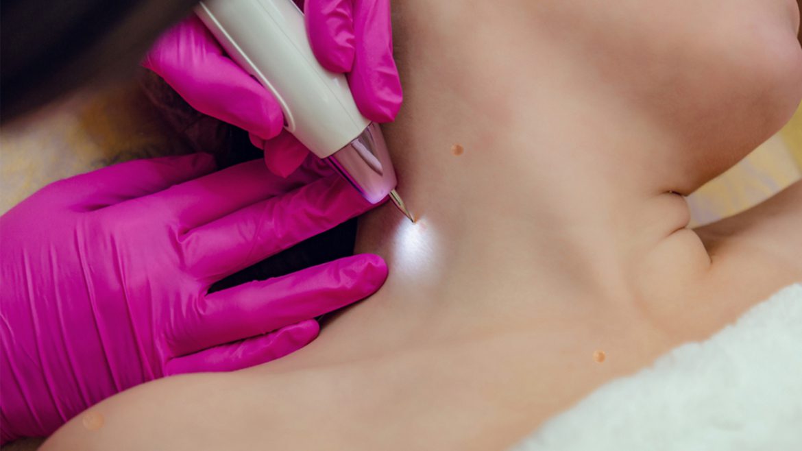 Dermatological Procedures Essential to Primary Care