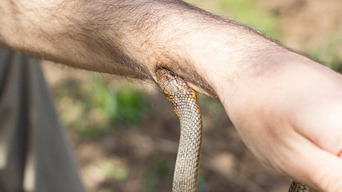 Travel related bites and poisoning