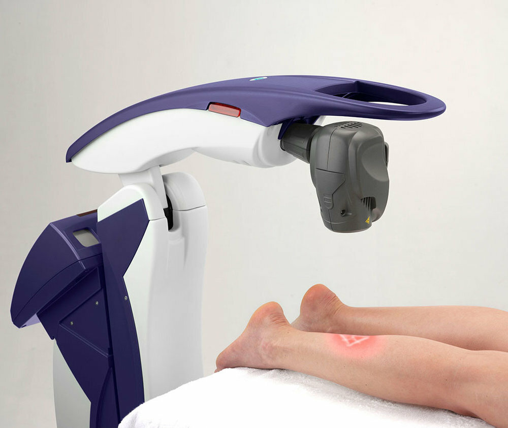 Non Surgical Knee Pain Treatment 5 MLS Laser Therapy is a pain laser used for plantar fasciitis, achilles tendonitis, neuromas, neuropathies, arthritis diabetic foot ulcers tendon and ligament injuries, strained muscles and sprained ligaments.