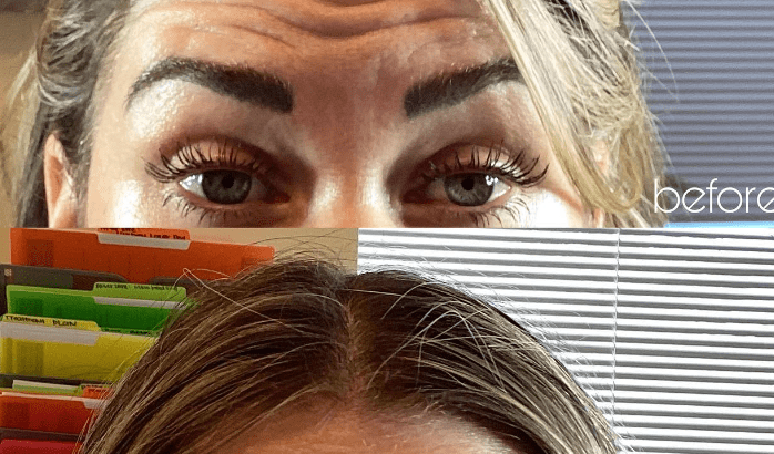 Services 25 Best Botox in Fremont